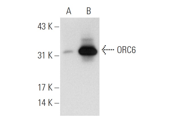 ORC6 (2679C2b): sc-81646. Western blot analysis of ORC6 expression in non-transfected: sc-117752 (A) and human ORC6 transfected: sc-116694 (B) 293T whole cell lysates.