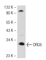 ORC6 (2679C2b): sc-81646. Western blot analysis of ORC6 expression in HeLa whole cell lysate.
