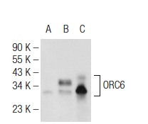 ORC6 (2679C2b): sc-81646. Western blot analysis of ORC6 expression in non-transfected 293: sc-110760 (A), human ORC6 transfected 293: sc-129354 (B) and HeLa (C) whole cell lysates.