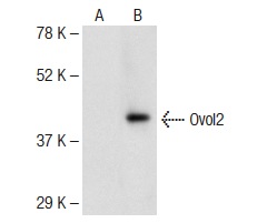 Ovol2 (T-18): sc-85803. Western blot analysis of Ovol2 expression in non-transfected: sc-117752 (A) and mouse Ovol2 transfected: sc-127277 (B) 293T whole cell lysates.