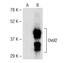 Ovol2 (T-18): sc-85803. Western blot analysis of Ovol2 expression in non-transfected: sc-117752 (A) and mouse Ovol2 transfected: sc-127276 (B) 293T whole cell lysates.