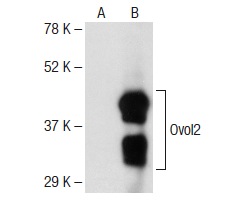 Ovol2 (T-18): sc-85803. Western blot analysis of Ovol2 expression in non-transfected: sc-117752 (A) and mouse Ovol2 transfected: sc-127275 (B) 293T whole cell lysates.