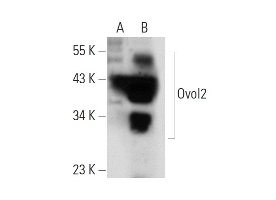 Ovol2 (T-18): sc-85803. Western blot analysis of Ovol2 expression in non-transfected: sc-117752 (A) and mouse Ovol2 transfected: sc-127275 (B) 293T whole cell lysates.