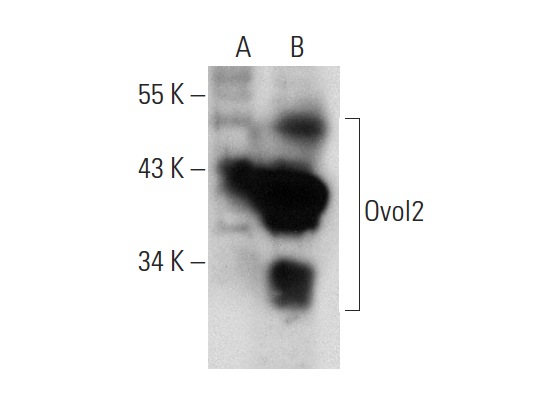 Ovol2 (T-18): sc-85803. Western blot analysis of Ovol2 expression in non-transfected: sc-117752 (A) and mouse Ovol2 transfected: sc-127276 (B) 293T whole cell lysates.