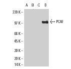 PCAF (E-8): sc-13124. Western blot analysis of 293 cells transfected with pEBB (A), pEBB/GCN5 (B), pCMV (C) or pCMV/PCAF (D). Kindly provided by Dr. Xicheng Mao, Burstein Lab, University of Michigan.