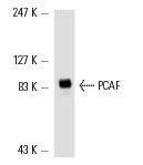 PCAF (E-8): sc-13124. Western blot analysis of PCAF expression in K-562 nuclear extract.
