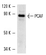PCAF (E-8): sc-13124. Western blot analysis of PCAF expression in Y79 whole cell lysate.