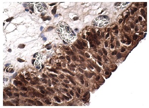 PCAF (E-8): sc-13124. Immunoperoxidase staining of formalin fixed, paraffin-embedded human urinary bladder tissue showing nuclear and cytoplasmic staining of urothelial cells.