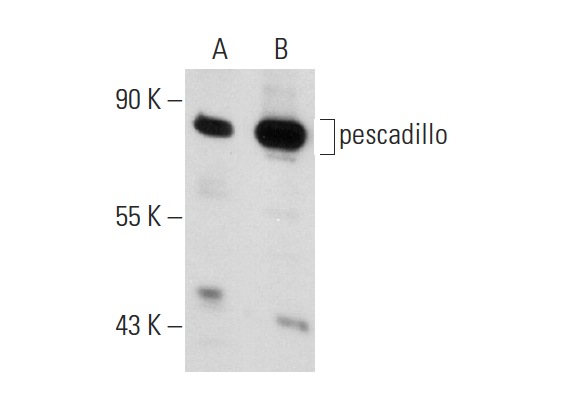 pescadillo (H-10): sc-166300. Western blot analysis of pescadillo expression in non-transfected: sc-117752 (A) and mouse pescadillo transfected: sc-125811 (B) 293T whole cell lysates.