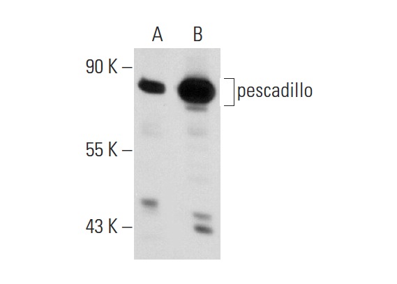 pescadillo (H-10): sc-166300. Western blot analysis of pescadillo expression in non-transfected: sc-110760 (A) and mouse pescadillo transfected: sc-111285 (B) 293 whole cell lysates.