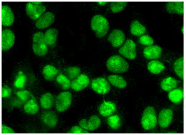 pescadillo (H-10): sc-166300. Immunofluorescence staining of formalin-fixed HepG2 cells showing nuclear and nucleolar localization.