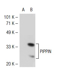 PIPPIN (473.1): sc-101108. Western blot analysis of PIPPIN expression in non-transfected: sc-117752 (A) and human PIPPIN transfected: sc-116980 (B) 293T whole cell lysates.