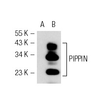 PIPPIN (473.1): sc-101108. Western blot analysis of PIPPIN expression in non-transfected: sc-117752 (A) and mouse PIPPIN transfected: sc-122591 (B) 293T whole cell lysates.