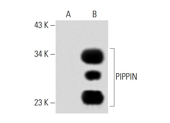 PIPPIN (473.1): sc-101108. Western blot analysis of PIPPIN expression in non-transfected: sc-117752 (A) and human PIPPIN transfected: sc-177729 (B) 293T whole cell lysates.