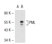 PML (H-238): sc-5621. Western blot analysis of PML expression in non-transfected: sc-117752 (A) and truncated mouse PML transfected: sc-122659 (B) 293T whole cell lysates.