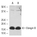 Elongin B (FL-118): sc-11447. Western blot analysis of Elongin B expression in HeLa (A) and Jurkat (B) whole cell lysates.