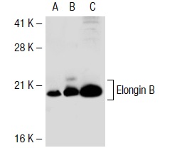 Elongin B (FL-118): sc-11447. Western blot analysis of Elongin B expression in non-transfected 293T: sc-117752 (A), human Elongin B transfected 293T: sc-117028 (B) and Jurkat (C) whole cell lysates.