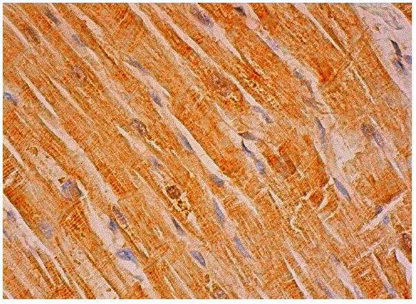 Elongin B (FL-118): sc-11447. Immunoperoxidase staining of formalin fixed, paraffin-embedded human heart muscle tissue showing cytoplasmic and nuclear staining of myocytes.