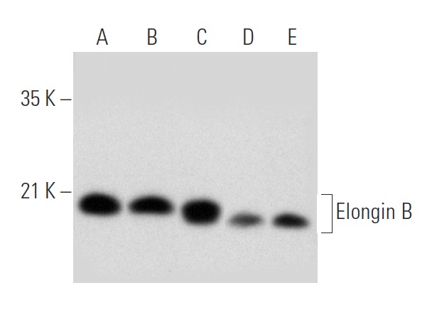 Elongin B (FL-118): sc-11447. Western blot analysis of Elongin B expression in K-562 (A), A-431 (B) and Jurkat (C) nuclear extracts and KNRK (D) and NIH/3T3 (E) whole cell lysates.