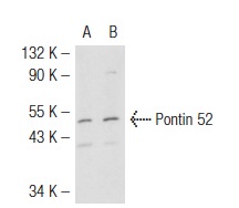 Pontin 52 (E-18): sc-49076. Western blot analysis of Pontin 52 expression in non-transfected: sc-117752 (A) and human Pontin 52 transfected: sc-113069 (B) 293T whole cell lysates.