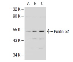 Pontin 52 (E-18): sc-49076. Western blot analysis of Pontin 52 expression in non-transfected 293T: sc-117752 (A), human Pontin 52 transfected 293T: sc-175102 (B) and SKBR-3 (C) whole cell lysates.
