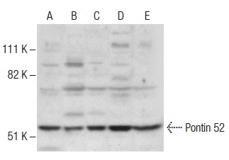 Pontin 52 (H-100): sc-48798. Western blot analysis of Pontin 52 expression in SK-BR-3 (A), KNRK (B), NIH/3T3 (C) and A-431 (D) nuclear extracts and NCI-H1299 whole cell lysate (E).