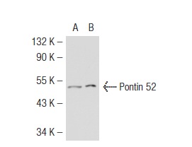 Pontin 52 (N-15): sc-15259. Western blot analysis of Pontin 52 expression in non-transfected: sc-117752 (A) and human Pontin 52 transfected: sc-113069 (B) 293T whole cell lysates.