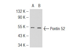 Pontin 52 (2943C1a): sc-81360. Western blot analysis of Pontin 52 expression in non-transfected: sc-117752 (A) and human Pontin 52 transfected: sc-113069 (B) 293T whole cell lysates.