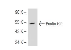 Pontin 52 (2943C1a): sc-81360. Western blot analysis of Pontin 52 expression in SK-BR-3 whole cell lysate.