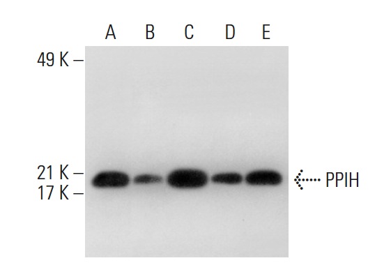PPIH (C-1): sc-377217. Western blot analysis of PPIH expression in HL-60 nuclear extract (A) and HeLa (B), THP-1 (C), Jurkat (D) and K-562 (E) whole cell lysates.