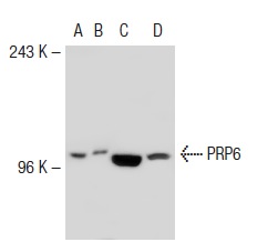 PRP6 (N-20): sc-13253. Western blot analysis of PRP6 expression in non-transfected: sc-117752 (A) and mouse PRP6 transfected: sc-127393 (B) 293T whole cell lysates and K-562 (C) and HL-60 (D) nuclear extracts.