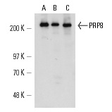 PRP8 (E-5): sc-55533. Western blot analysis of PRP8 expression in Y79 nuclear extract (A) and CTLL-2 (B) and KNRK (C) whole cell lysates.