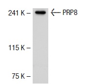 PRP8 (E-5): sc-55533. Western blot analysis of PRP8 expression in K-562 nuclear extract.