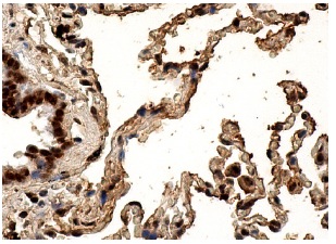 PRP8 (E-5): sc-55533. Immunoperoxidase staining of formalin fixed, paraffin-embedded human lung tissue showing nuclear staining of pneumocytes, macrophages and respiratory epithelial cells.