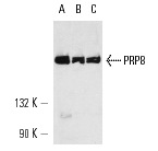 PRP8 (H-300): sc-30207. Western blot analysis of PRP8 expression in Y79 (A), K-562 (B) and Jurkat (C) whole cell lysates.