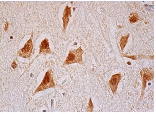 PRP8 (H-300): sc-30207. Immunoperoxidase staining of formalin fixed, paraffin-embedded human cerebral cortex tissue showing nuclear and cytoplasmic staining of neuronal cells.