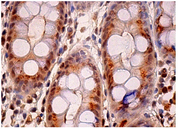 RbAp46 (N-19): sc-8272. Immunoperoxidase staining of formalin fixed, paraffin-embedded human colon tissue showing nuclear and cytoplasmic staining of glandular cells.