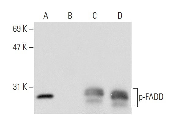 Western blot analysis of FADD phosphorylation in untreated (A,C) and treated (B,D) A-431 whole cell lysates. Antibodies tested include p-FADD (Ser 194): sc-12439 (A,B) and FADD (H-181): sc-5559 (C,D).