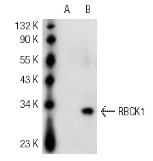 RBCK1 (P-19): sc-49718. Western blot analysis of RBCK1 expression in non-transfected 293: sc-110760 (A), human RBCK1 transfected 293: sc-110821 (B) and A-431 (C) whole cell lysates.