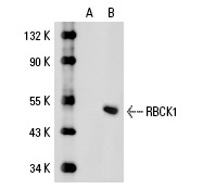 RBCK1 (P-19): sc-49718. Western blot analysis of RBCK1 expression in non-transfected: sc-110760 (A) and human RBCK1 transfected: sc-111206 (B) 293 whole cell lysates.