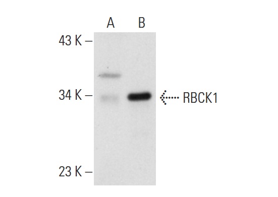RBCK1 (P-19): sc-49718. Western blot analysis of RBCK1 expression in non-transfected: sc-117752 (A) and human RBCK1 transfected: sc-158916 (B) 293T whole cell lysates.