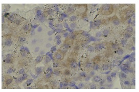 FADD (H-181): sc-5559. Immunoperoxidase staining of formalin fixed, paraffin-embedded mouse kidney tissue showing cytoplasmic localization.