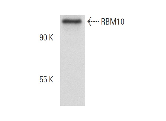 RBM10 (E-18): sc-69600. Western blot analysis of RBM10 expression in Daudi whole cell lysate.