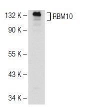 RBM10 (E-18): sc-69600. Western blot analysis of RBM10 expression in K-562 whole cell lysate.