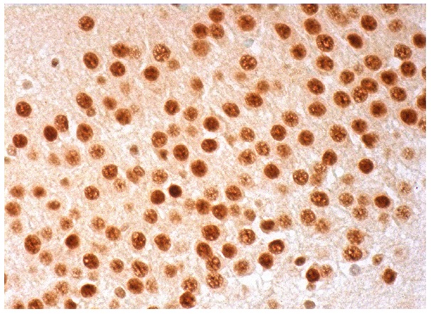 RBM10 (E-18): sc-69600. Immunoperoxidase staining of formalin fixed, paraffin-embedded human hippocampus tissue showing nuclear staining of neuronal cells and glial cells.