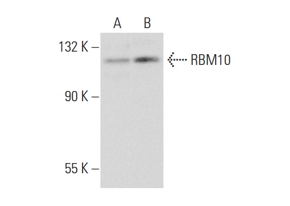 RBM10 (E-18): sc-69600. Western blot analysis of RBM10 expression in NIH/3T3 (A) and U-251-MG (B) whole cell lysates.