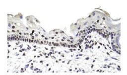 RBM28 (Z-22): sc-102075. Immunoperoxidase staining of formalin fixed, paraffin-embedded human heart tissue showing nuclear staining.