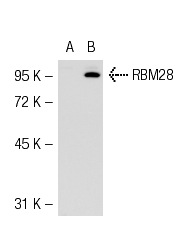 RBM28 (Z-22): sc-102075. Western blot analysis of RBM28 expression in non-transfected: sc-117752 (A) and mouse RBM28 transfected: sc-123006 (B) 293T whole cell lysates.