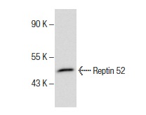 Reptin 52 (N-20): sc-34751. Western blot analysis of Reptin 52 expression in HeLa whole cell lysate.