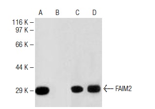  FAIM2 (H-21): sc-130663. Western blot analysis of FAIM2 expression in human brain tissue extract in the absence (A) and the presence (B) of immunizing peptide, mouse brain (C) and rat brain (D) tissue extracts.